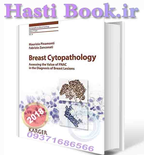 دانلود کتاب  Breast Cytopathology: Assessing the Value of Fnac in the Diagnosis of Breast Lesions (Monographs in Clinical Cytology) 1st Edition 2018 (ORIGINAL PDF)